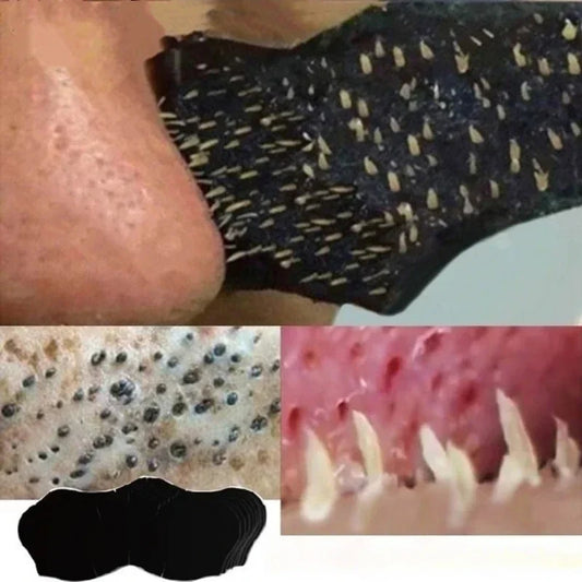Blackhead Removing Nose Strip Set - Pore Cleansing Mask Patches