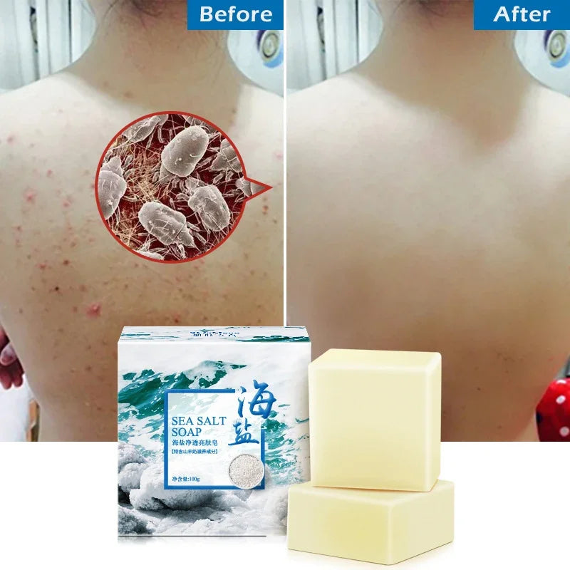 Sea Salt Moisturizing Soap - Face and Body Cleansing Bar