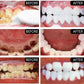 5-Day Teeth Whitening Powder - Plaque and Stain Cleaning Care