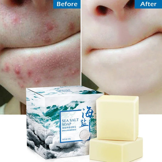 Sea Salt Moisturizing Soap - Face and Body Cleansing Bar