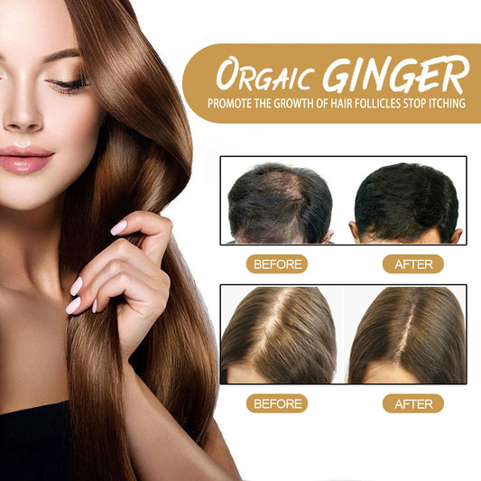 60g Natural Ginger Shampoo Soap - Scalp Cleansing Hair Bar