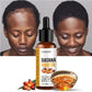 Lewedo Batana Hair Oil - Nourishing Shine Care for Men and Women